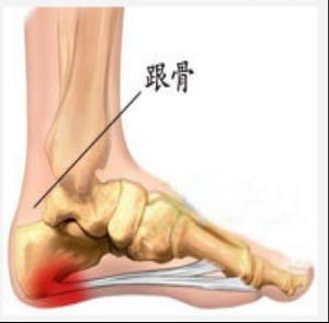 关节镜手术适合骨刺吗.jpg